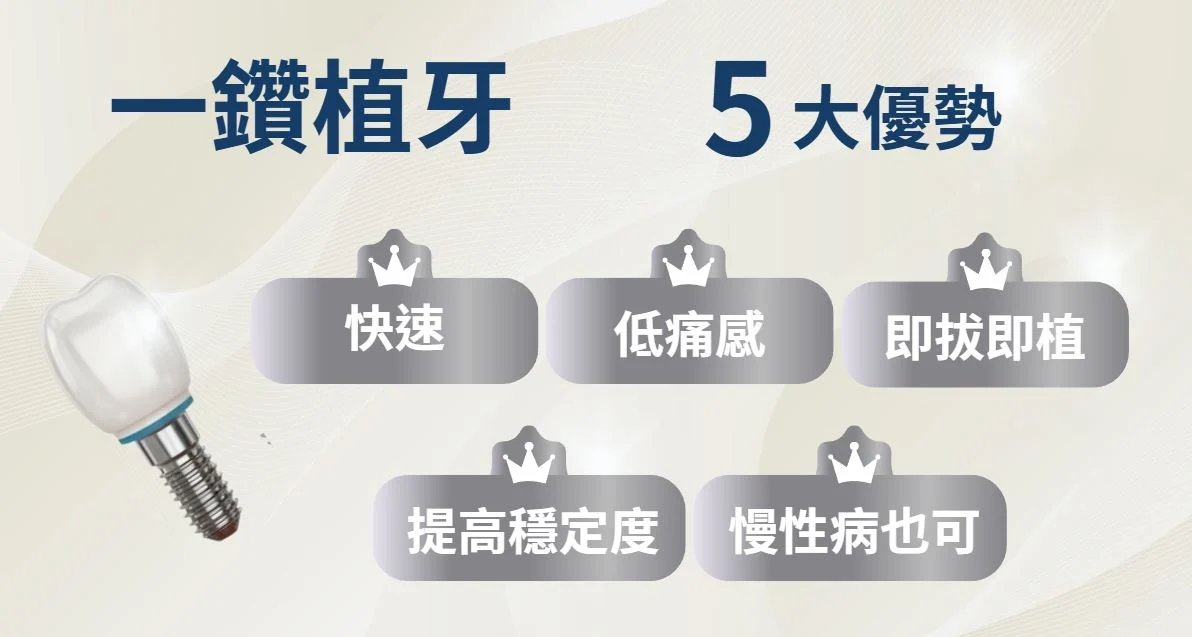 一鑽植牙5優勢